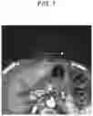 Fig. 08 - Medical image processing apparatus, medical image processing method and medical image processing system