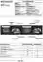 Fig. 29 - MULTIMODAL MODELING SYSTEMS AND METHODS FOR PREDICTING AND MANAGING DEMENTIA RISK FOR INDIVIDUALS