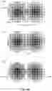 Fig. 09 - Method and apparatus for charged particle detection