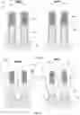 Fig. 02 - Gate spacer formation for scaled CMOS devices