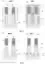 Fig. 04 - Gate spacer formation for scaled CMOS devices