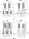 Fig. 05 - Gate spacer formation for scaled CMOS devices