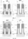 Fig. 07 - Gate spacer formation for scaled CMOS devices
