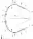 Fig. 03 - Headphone device