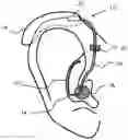 Fig. 01 - Method of customizing a hearing device component, a hearing device component and a hearing device