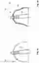 Fig. 03 - Method of customizing a hearing device component, a hearing device component and a hearing device