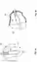 Fig. 06 - Method of customizing a hearing device component, a hearing device component and a hearing device