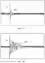 Fig. 08 - Induction heating device performing container sensing function