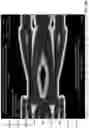 Fig. 06 - Low frequency reduced passive equalizer