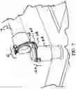 Fig. 09 - Adjustable height connection device for water irrigation