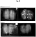 Fig. 06 - Rat model of down syndrome and method for producing same