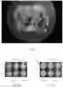 Fig. 04 - LICHEN COMPOUNDS THAT INHIBIT MYCOTOXIN PRODUCTION