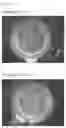 Fig. 05 - METHOD FOR PRODUCING PREPARATION CONTAINING THICKENING POLYSSACCHARIDE