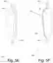 Fig. 11 - FEMUR/HIP PROTECTION SYSTEM
