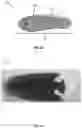Fig. 06 - Three-dimensional shoe