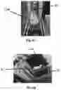 Fig. 08 - Three-dimensional shoe