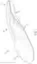 Fig. 02 - INSOLE FOR RELIEVING PLANTAR FACSIITIS PAIN