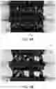 Fig. 07 - Shoe upper