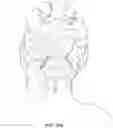 Fig. 11 - Hair Retaining Device and Method of Using Same