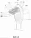 Fig. 09 - Oral care implement