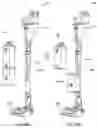 Fig. 108 - Surface cleaning apparatus