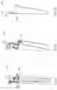 Fig. 115 - Surface cleaning apparatus