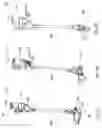 Fig. 30 - Surface cleaning apparatus