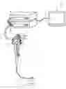 Fig. 01 - ENDOSCOPE