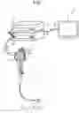 Fig. 02 - ENDOSCOPE