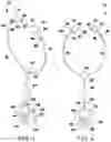 Fig. 02 - Ear ailment diagnostic device and method