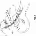 Fig. 02 - INTUBATION ACCESSORY