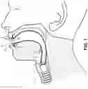 Fig. 02 - Orophrangeal glove for use with a rigid bronchscope and a method