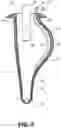 Fig. 05 - Orophrangeal glove for use with a rigid bronchscope and a method