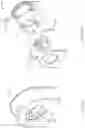 Fig. 04 - Atherectomy catheter drive assemblies