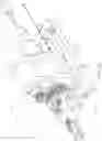Fig. 09 - Atherectomy catheter drive assemblies