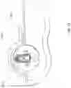 Fig. 22 - Atherectomy catheter drive assemblies