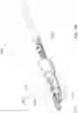 Fig. 25 - Atherectomy catheter drive assemblies