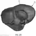 Fig. 04 - CARDIAC MAPPING SYSTEMS, METHODS, AND KITS INCLUDING FIDUCIAL MARKERS