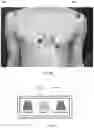 Fig. 06 - CARDIAC MAPPING SYSTEMS, METHODS, AND KITS INCLUDING FIDUCIAL MARKERS