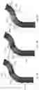 Fig. 07 - Esophageal deflection device