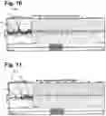 Fig. 08 - System and method for composite display of subcutaneous cardiac monitoring data
