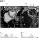 Fig. 04 - Method and device for analyzing acquired magnetic resonance images