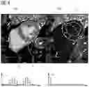 Fig. 05 - Method and device for analyzing acquired magnetic resonance images