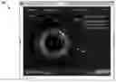 Fig. 01 - Intravascular imaging procedure-specific workflow guidance and associated devices, systems, and methods