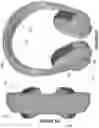 Fig. 08 - Biosignal headphones