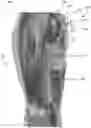 Fig. 01 - Method and system for neurohydrodissection