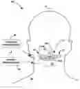 Fig. 01 - Determining nerve location relative to electrodes