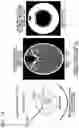 Fig. 15 - Interior CT image generation method