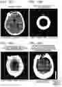 Fig. 17 - Interior CT image generation method