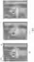 Fig. 04 - Field of view adjustment